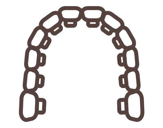ブラケットとワイヤーで歯並びを整える
