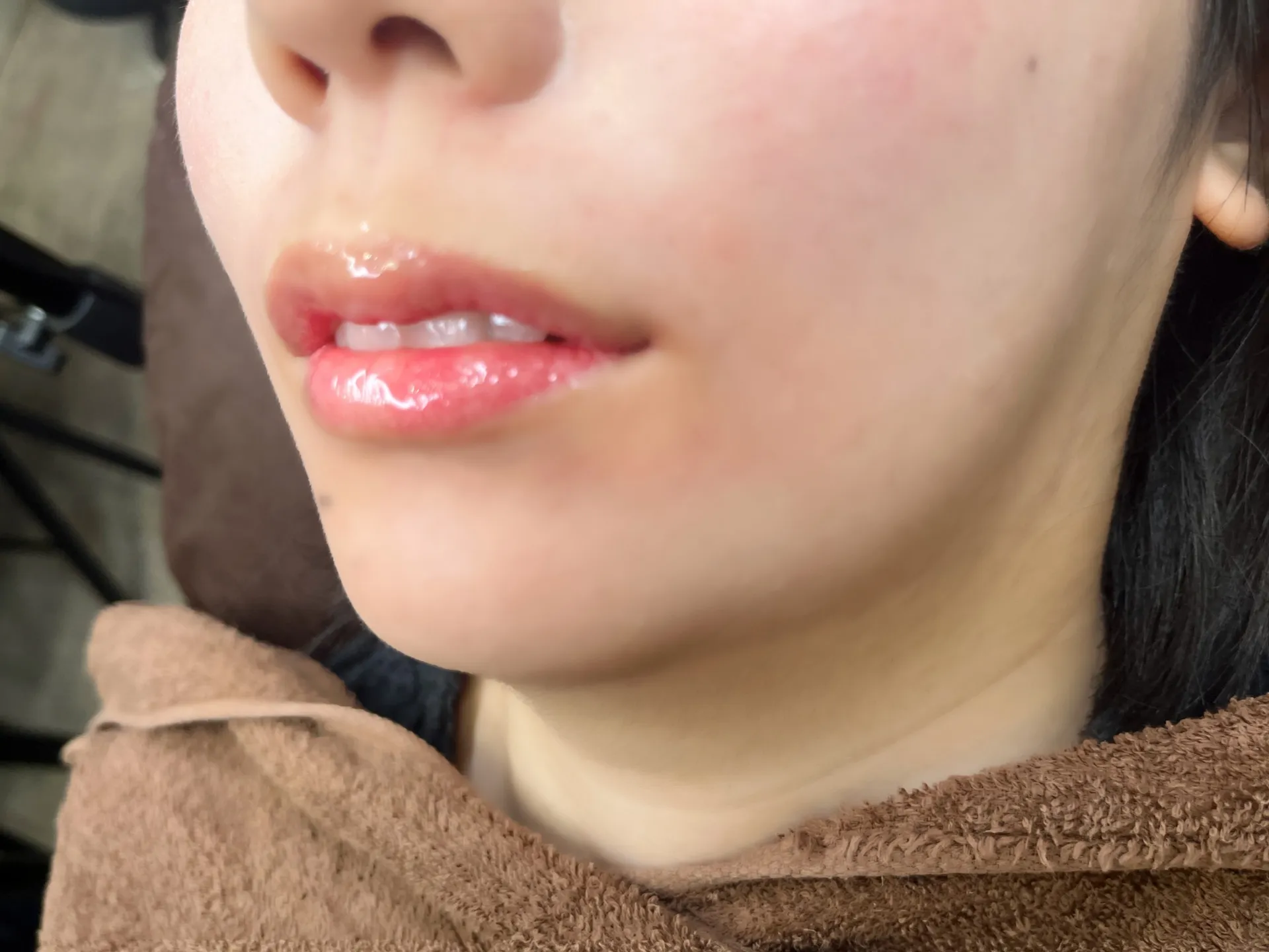 歯科視点で考えるリップアートメイクの魅力