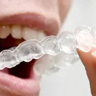 ホワイトニング・ガムピーリング